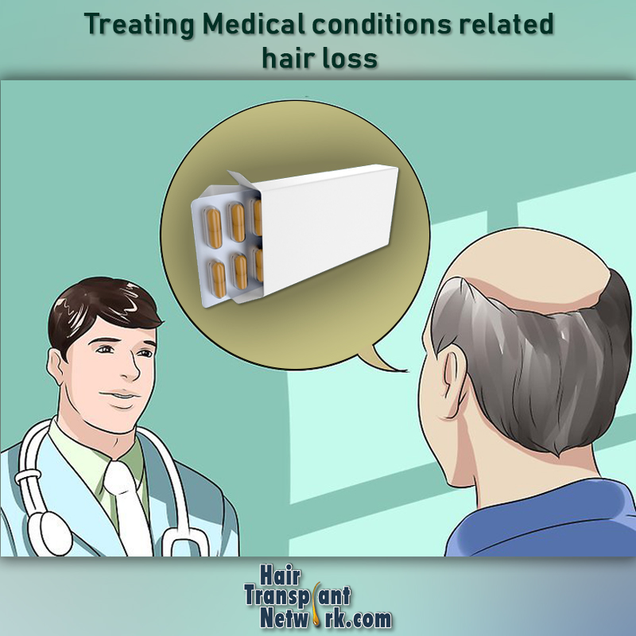 Illustration for article titled Treating Medical Conditions Related Hair Loss